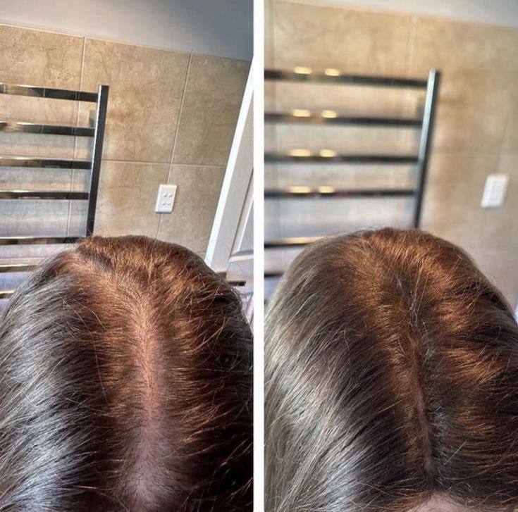 Hair & Scalp Treatment