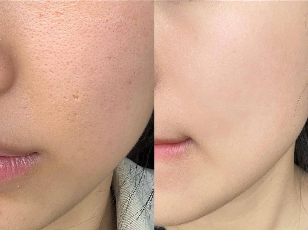 Oily & Congested Skin