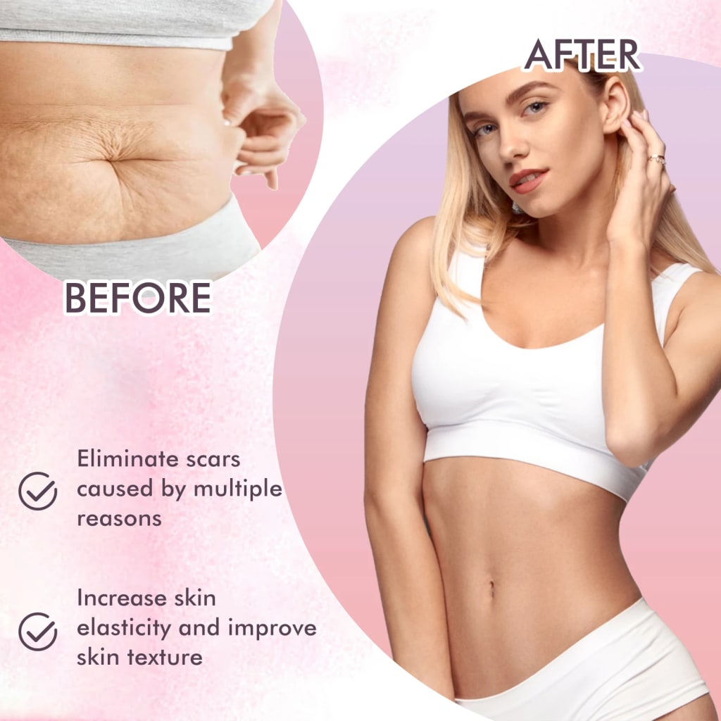 Oceaura Body Skin Care Oil Non-greasy Reduce Scars and Stretch Marks Fade Wrinkles Improve Skin Texture Smoothing Body Oil
